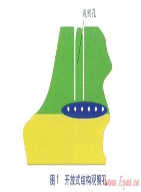 燃?xì)饩垡蚁┕艿离娙圻B接兩個(gè)典型問(wèn)題分析